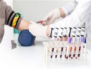 Centro prelievi,stop fino a settembre’20 Sindaco Campobasso, resta in funzione servizio vaccinazioni
