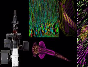 Microscopia Ottica a Fluorescenza e Intelligenza artificiale, straordinario strumento all’avanguardia operativo all’UniMol